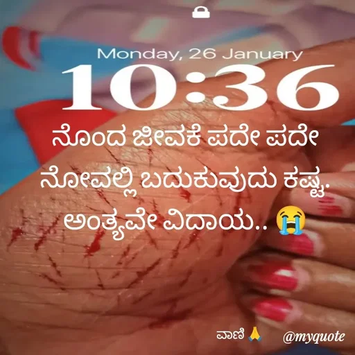 Quote by ನೊಂದ ಮನಸು... 🙂 - ನೊಂದ ಜೀವಕೆ ಪದೇ ಪದೇ ನೋವಲ್ಲಿ ಬದುಕುವುದು ಕಷ್ಟ.
ಅಂತ್ಯವೇ ವಿದಾಯ.. 😭

                                                       

                                            ವಾಣಿ 🙏 - Made using Quotes Creator App, Post Maker App