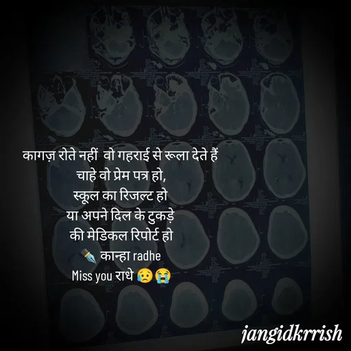Quote by Kanha Jangid - कागज़ रोते नहीं  वो गहराई से रूला देते हैं 
चाहे वो प्रेम पत्र हो,
स्कूल का रिजल्ट हो 
या अपने दिल के टुकड़े 
की मेडिकल रिपोर्ट हो
✒️ कान्हा radhe 
Miss you राधे 😥😭
 - Made using Quotes Creator App, Post Maker App